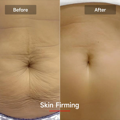 EMS Contouring Belt