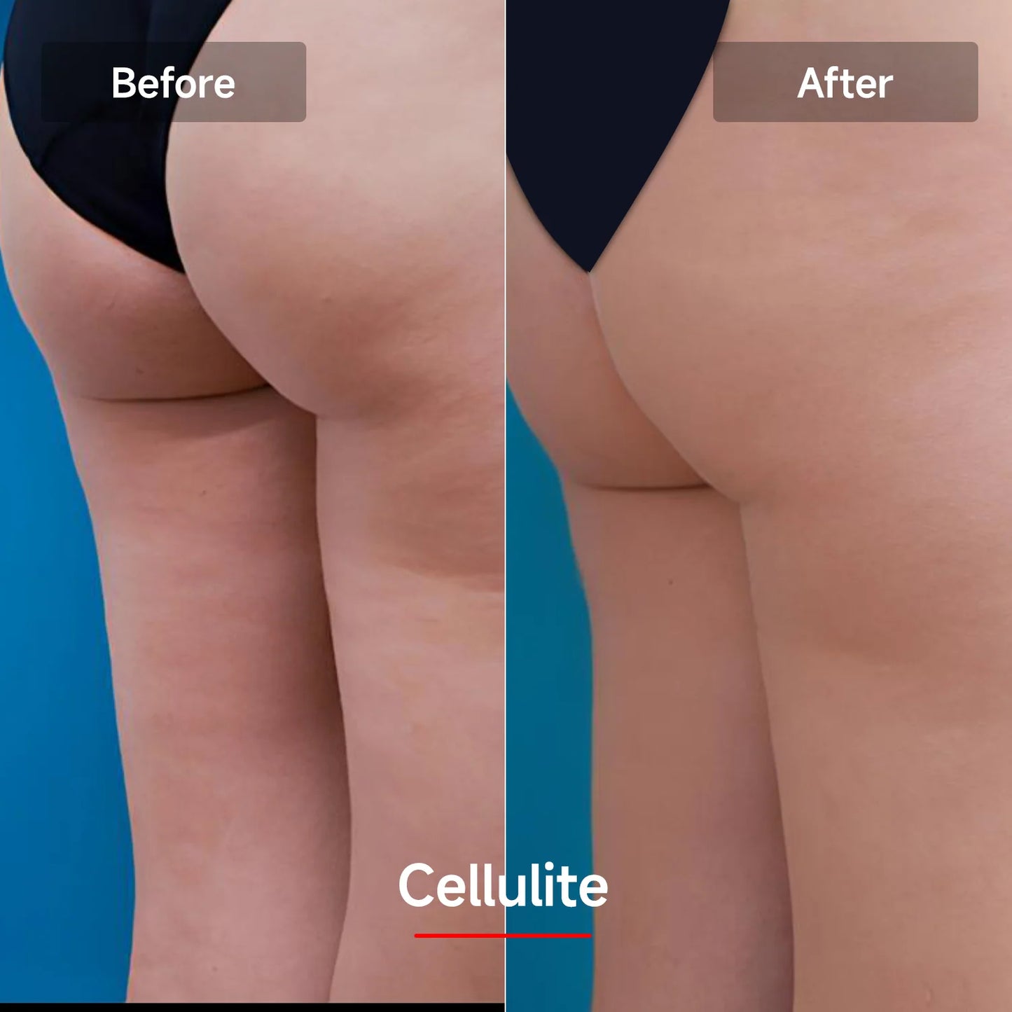 EMS Contouring Belt