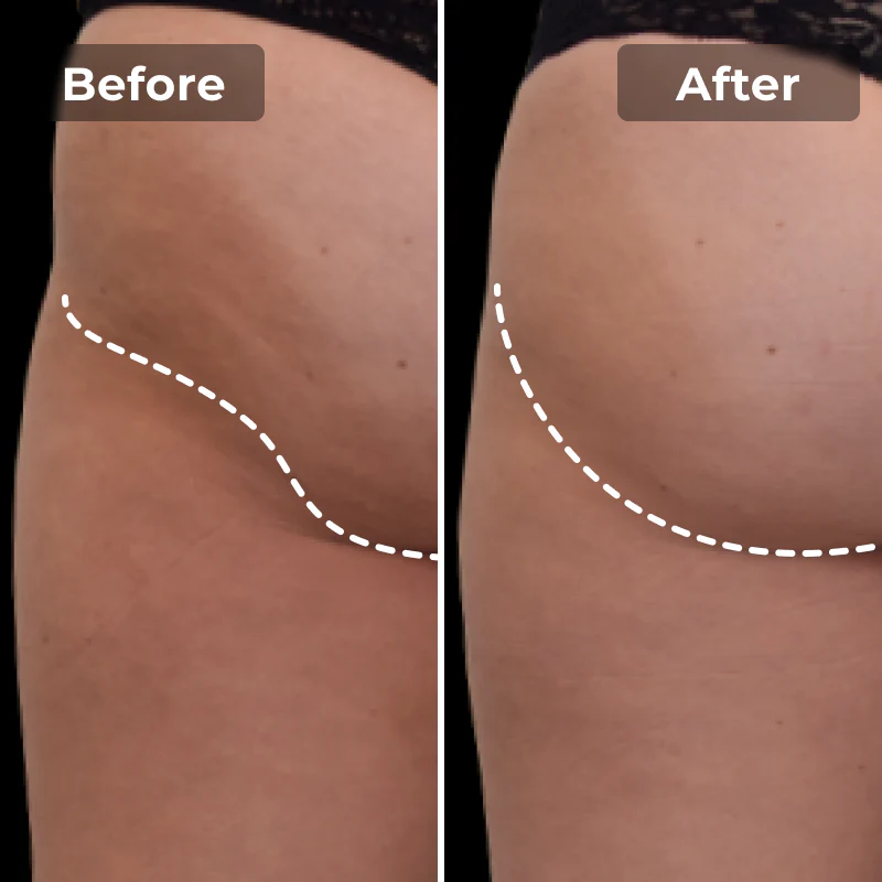 EMS Toning Shorts